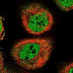p53R2 Antibody, Novus Biologicals 0.1mL; Unlabeled:Antibodies, Polyclonal